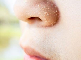 How To Heal Dry, Flaky Skin Around The Nose