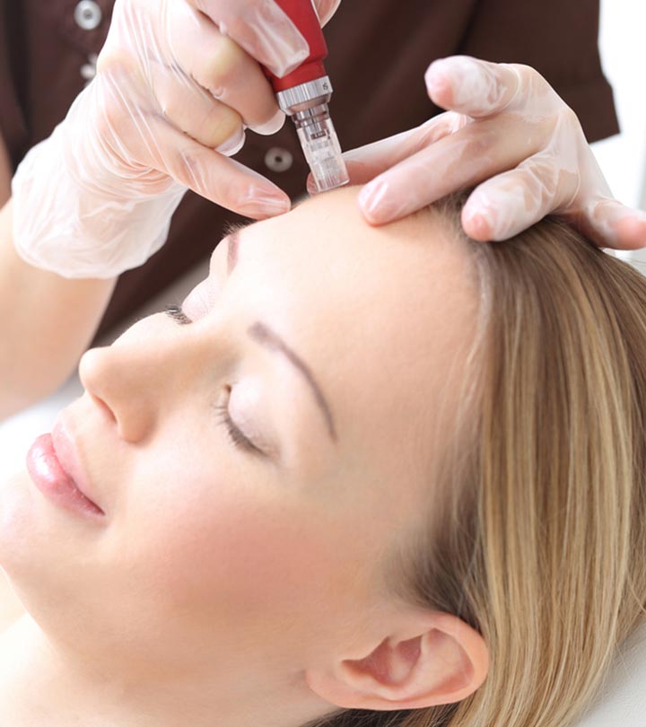 Mesotherapy For The Face – Benefits, Procedure, And Side Effects