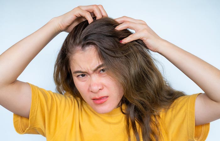 Woman scratching her itchy scalp due to the side effects of coconut oil
