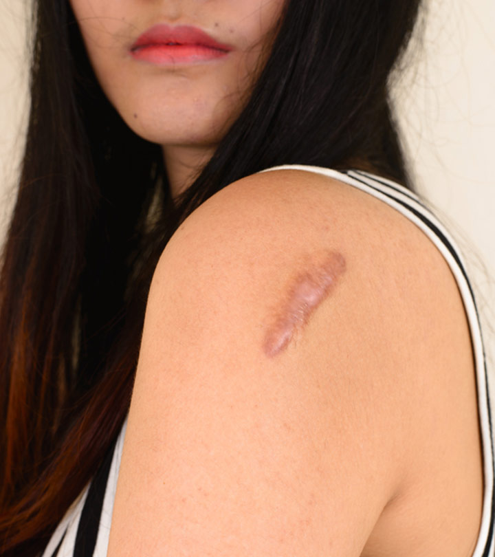 What Causes Skin Lesions? How Do You Treat Them?